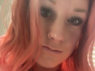 Freckles444