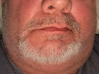 Grower72