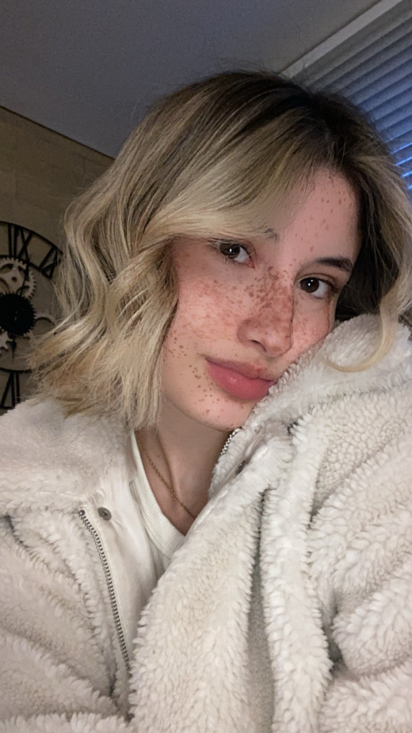 AliceLens